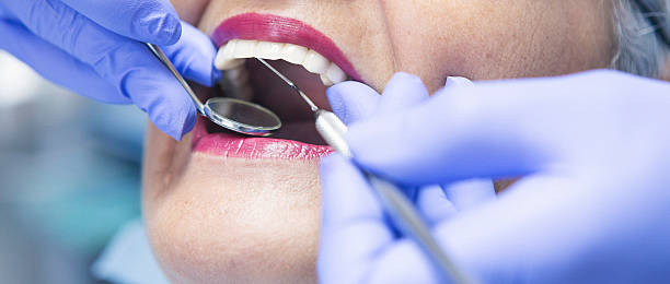 Best Mobile Emergency Dentist in Milton, WA